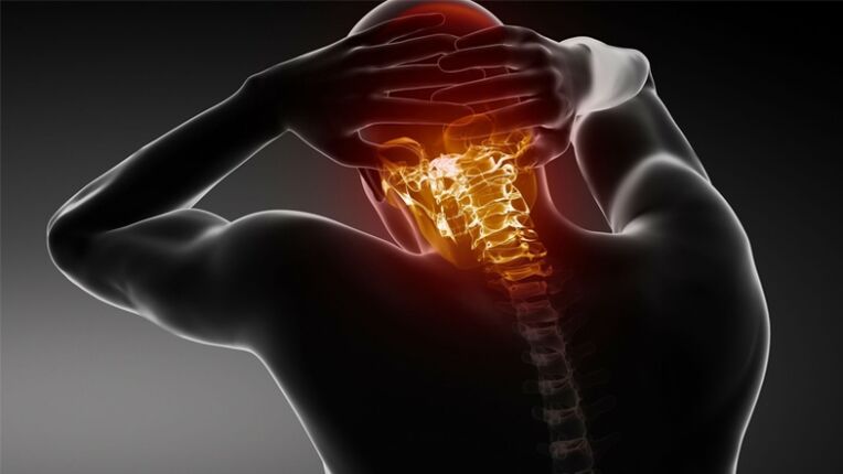 ból tyłu głowy z osteochondrozą szyjną