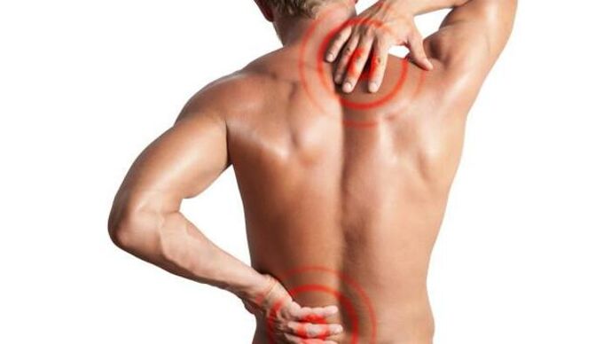 ból spowodowany osteochondrozą